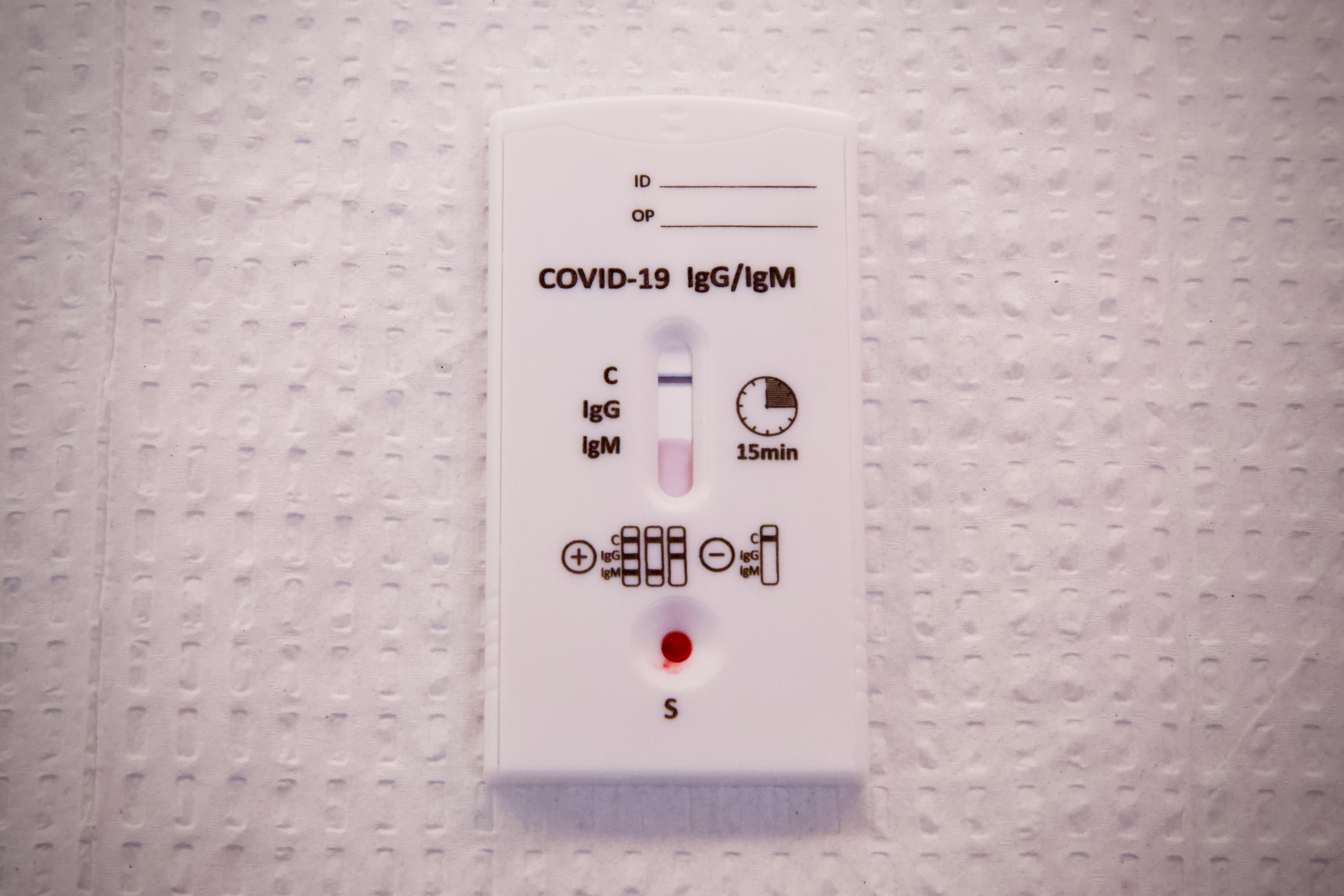 COVID-19 antibody test